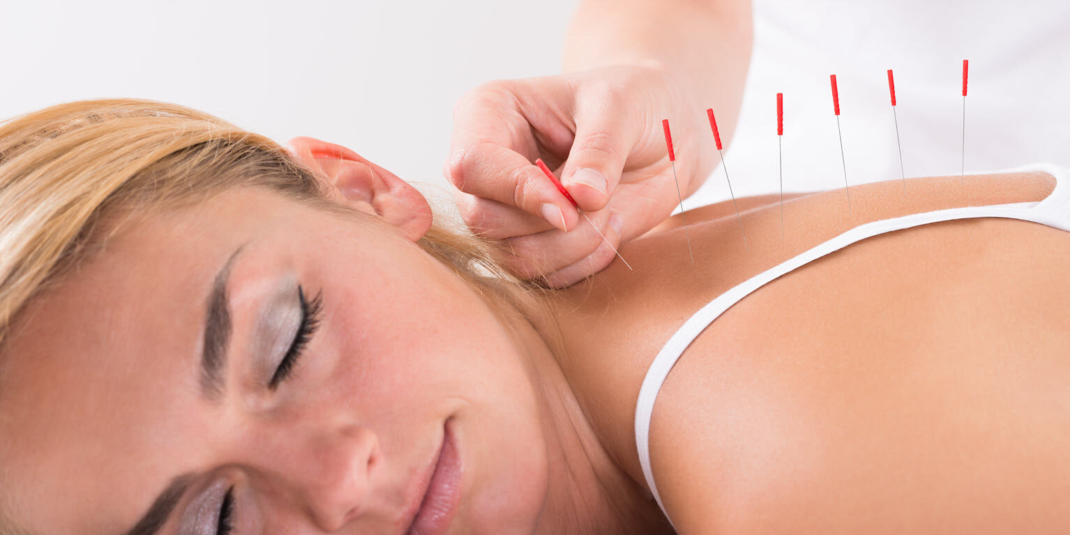 acupuncture - Manchester